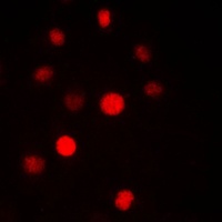 SAP14 Rabbit Polyclonal Antibody