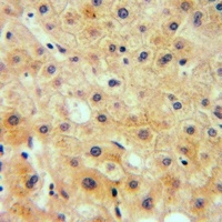 RAB23 Rabbit Polyclonal Antibody