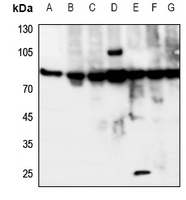 IL-20RA Antibody