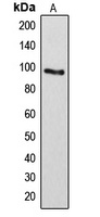 ARHGAP17 Rabbit Polyclonal Antibody