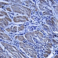 TRIM68 Antibody