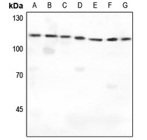 IARS2 Rabbit Polyclonal Antibody