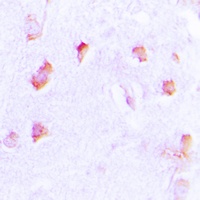 Collagen 20 alpha 1 Antibody