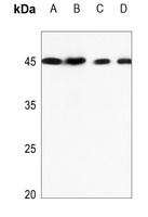 TRIB3 Rabbit Polyclonal Antibody