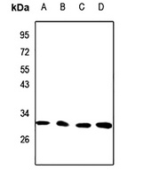 CTDSP1 Rabbit Polyclonal Antibody