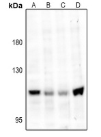 TRPV4 Rabbit Polyclonal Antibody