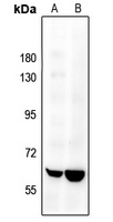 SENP2 Antibody