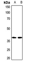 NIP1 Rabbit Polyclonal Antibody