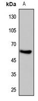 HIF3 alpha Rabbit Polyclonal Antibody
