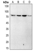 Artemis (Phospho-S516) Rabbit Polyclonal Antibody