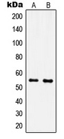 IPPK Rabbit Polyclonal Antibody