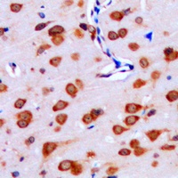 IPPK Rabbit Polyclonal Antibody