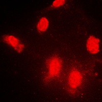 IPPK Rabbit Polyclonal Antibody