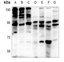 EPS8L2 Rabbit Polyclonal Antibody