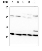 MRPL14 Rabbit Polyclonal Antibody