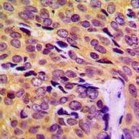 MRPL14 Rabbit Polyclonal Antibody