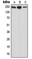 WNK2 Rabbit Polyclonal Antibody