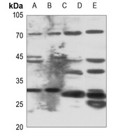 ELOVL6 Rabbit Polyclonal Antibody