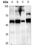 SUV39H2 Rabbit Polyclonal Antibody