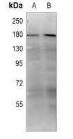 Collagen 18 alpha 1 Antibody