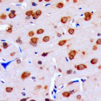 DUSP16 Rabbit Polyclonal Antibody
