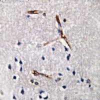 ACRBP Rabbit Polyclonal Antibody