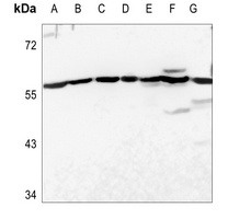 USP30 Rabbit Polyclonal Antibody