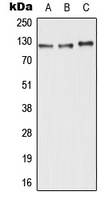 ABCC11 Rabbit Polyclonal Antibody