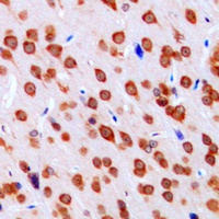 DCLK3 Rabbit Polyclonal Antibody