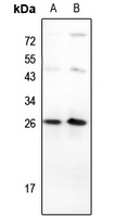 TP53INP1 Rabbit Polyclonal Antibody