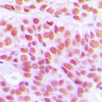 Histone H4 (Acetyl-K12) Antibody