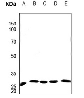 APOA1BP Rabbit Polyclonal Antibody