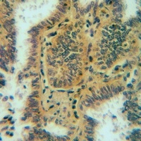 APOA1BP Rabbit Polyclonal Antibody