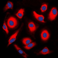 APOA1BP Rabbit Polyclonal Antibody