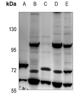 IL-31RA Antibody