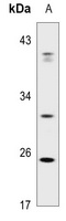 ABCC13 Rabbit Polyclonal Antibody