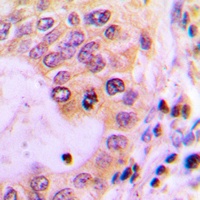 ABCC13 Rabbit Polyclonal Antibody