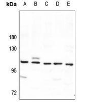 SYNE3 Antibody