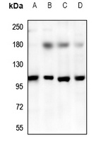 TRPV3 Rabbit Polyclonal Antibody