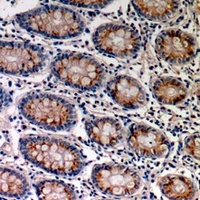 TRPV3 Rabbit Polyclonal Antibody