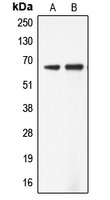 ADCK5 Rabbit Polyclonal Antibody