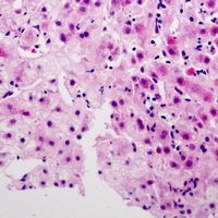 SERINC2 Rabbit Polyclonal Antibody