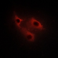 SERINC2 Rabbit Polyclonal Antibody