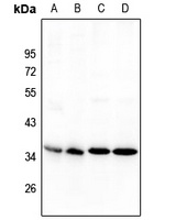 NANOGP8 Rabbit Polyclonal Antibody