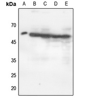 p47 phox (Phospho-S370) Rabbit Polyclonal Antibody