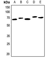 Serpin A3 Rabbit Polyclonal Antibody