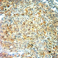 Serpin A3 Rabbit Polyclonal Antibody