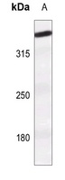 ATM (Phospho-S1981) Rabbit Polyclonal Antibody