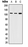 SERCA2 Rabbit Polyclonal Antibody