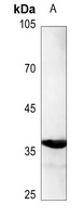 C/EBP alpha (Phospho-S193) Rabbit Polyclonal Antibody